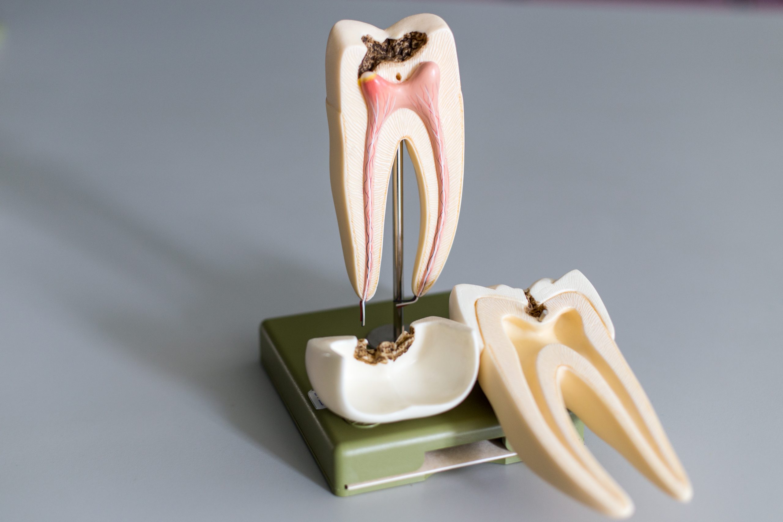 Dealing with A Damaged Tooth: What to Do and How Best to Fix It