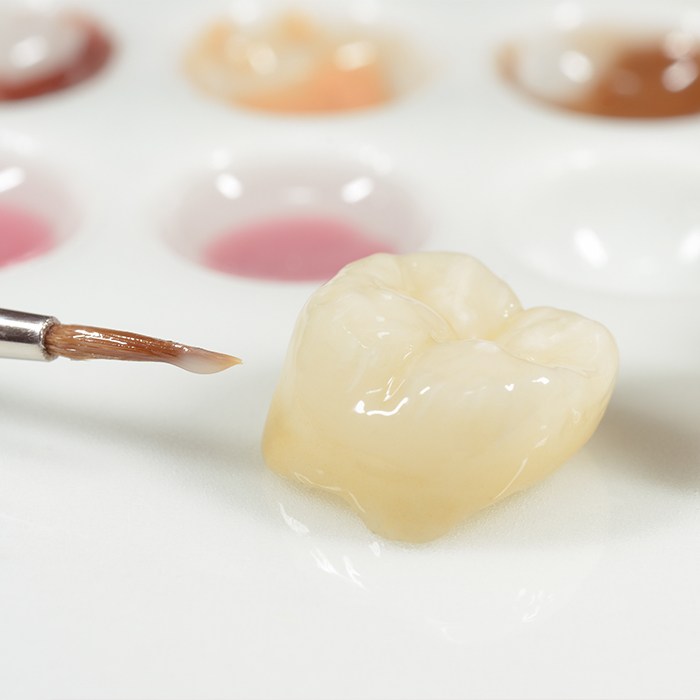 Custom dental crown restorative dentistry solution prior to placement