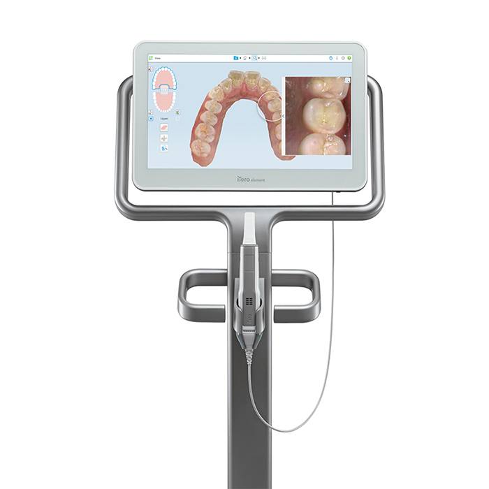 iTero digital dental crown design on chairside computer screen