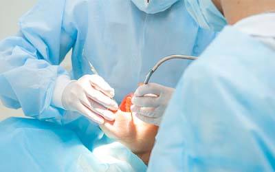 implant dentist in Grove City performing implant placement