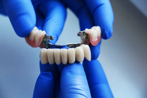 Achieve a Perfect Smile with Dental Bridges